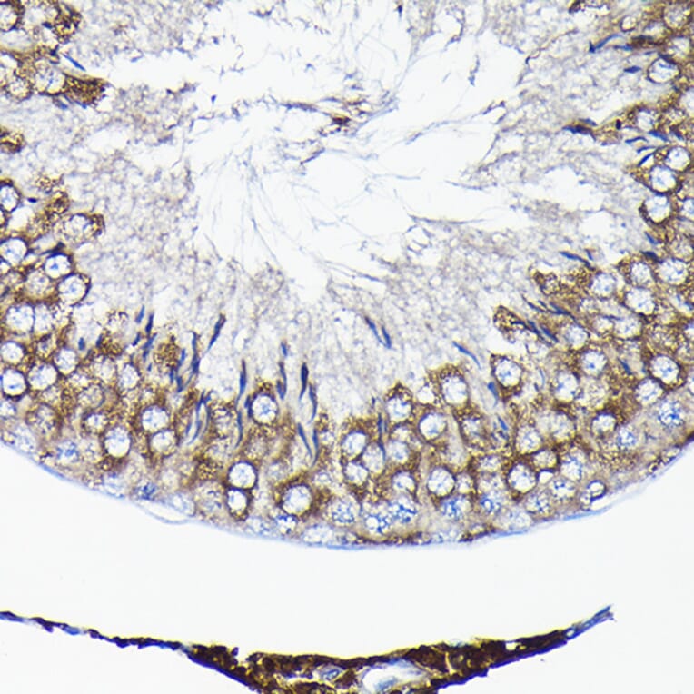 Immunohistochemistry - Anti-TCP1 alpha/CCTA Antibody (A90697) - Antibodies.com
