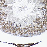 Immunohistochemistry - Anti-TCP1 alpha/CCTA Antibody (A90697) - Antibodies.com