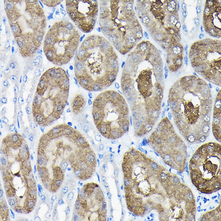 Immunohistochemistry - Anti-TCP1 alpha/CCTA Antibody (A90697) - Antibodies.com
