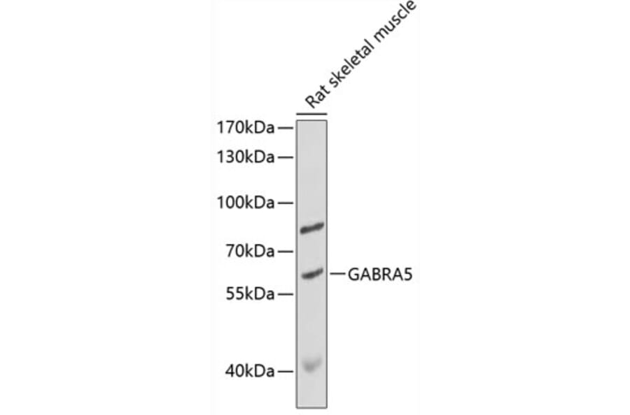 Western Blot - Anti-GABA A Receptor alpha 5/GABRA5 Antibody (A90698) - Antibodies.com