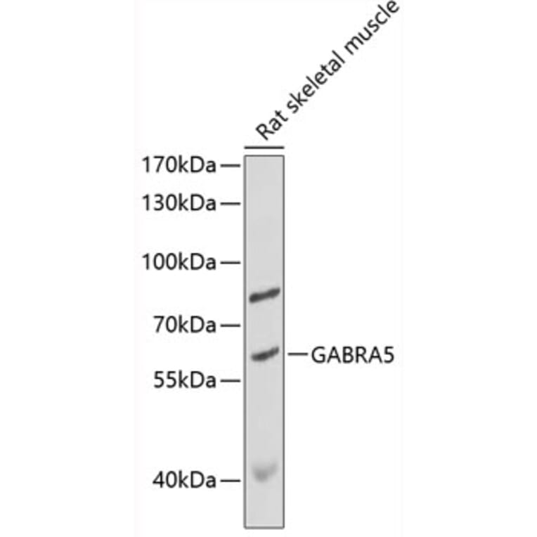 Western Blot - Anti-GABA A Receptor alpha 5/GABRA5 Antibody (A90698) - Antibodies.com