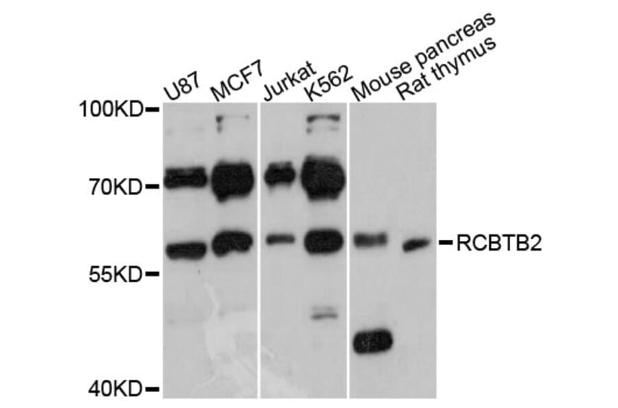 Western Blot - Anti-RCBTB2 Antibody (A3785) - Antibodies.com