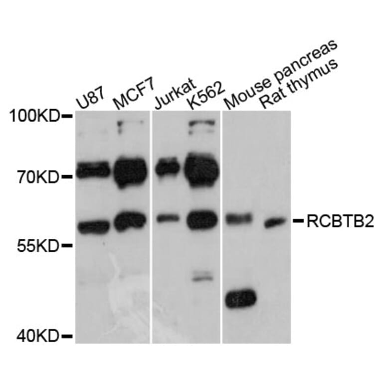 Western Blot - Anti-RCBTB2 Antibody (A3785) - Antibodies.com