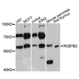 Western Blot - Anti-RCBTB2 Antibody (A3785) - Antibodies.com