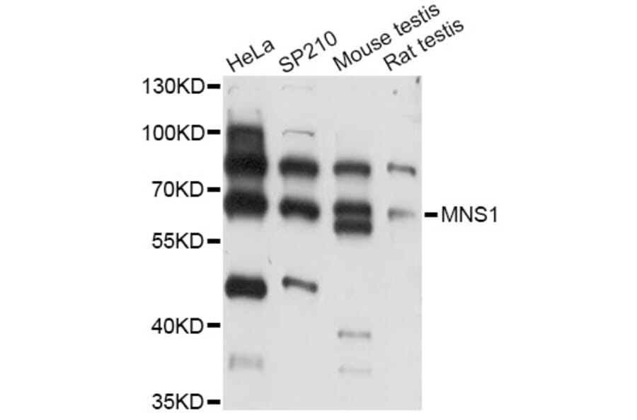 Western Blot - Anti-MNS1 Antibody (A14363) - Antibodies.com