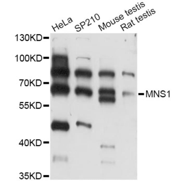 Western Blot - Anti-MNS1 Antibody (A14363) - Antibodies.com