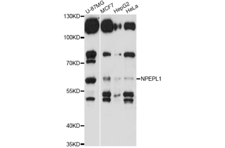 Western Blot - Anti-NPEPL1 Antibody (A14423) - Antibodies.com