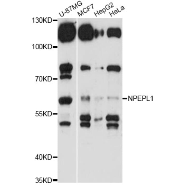 Western Blot - Anti-NPEPL1 Antibody (A14423) - Antibodies.com