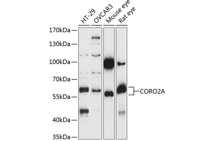 Western Blot - Anti-CORO2A Antibody (A90702) - Antibodies.com