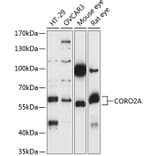 Western Blot - Anti-CORO2A Antibody (A90702) - Antibodies.com