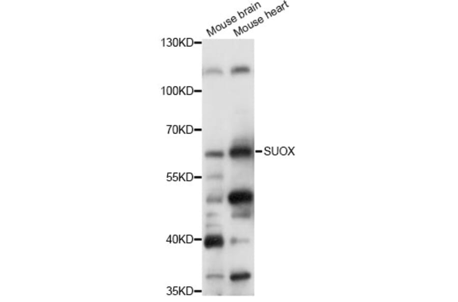 Western Blot - Anti-SUOX Antibody (A14258) - Antibodies.com