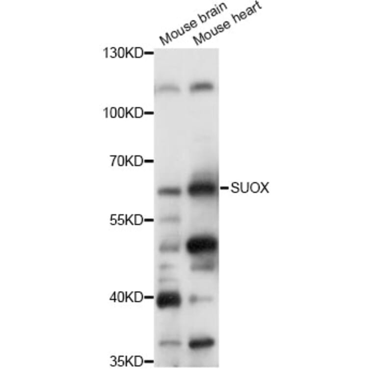 Western Blot - Anti-SUOX Antibody (A14258) - Antibodies.com