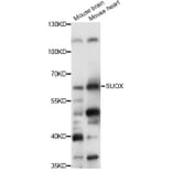 Western Blot - Anti-SUOX Antibody (A14258) - Antibodies.com