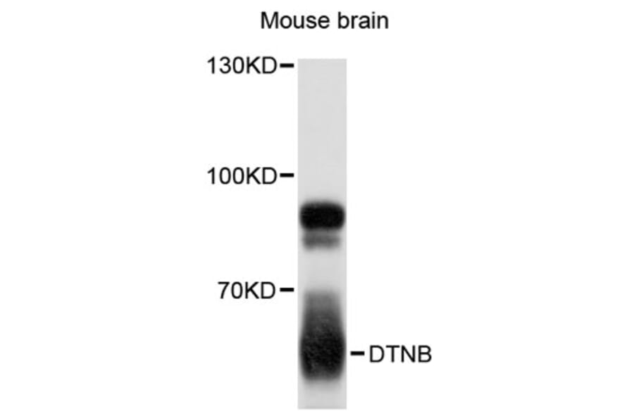 Western Blot - Anti-DTNB Antibody (A12866) - Antibodies.com