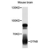 Western Blot - Anti-DTNB Antibody (A12866) - Antibodies.com