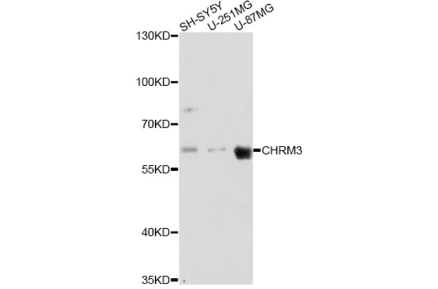 Western Blot - Anti-CHRM3 Antibody (A14560) - Antibodies.com