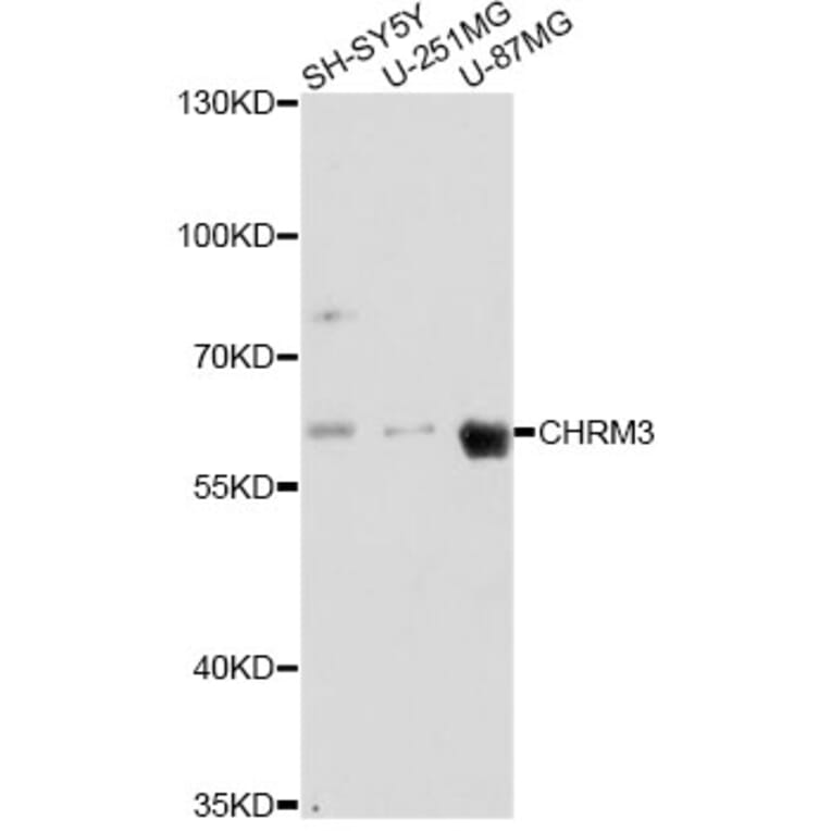 Western Blot - Anti-CHRM3 Antibody (A14560) - Antibodies.com