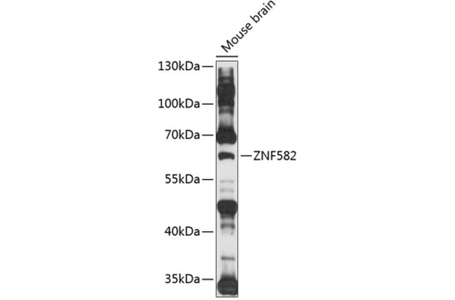 Western Blot - Anti-ZNF582 Antibody (A90706) - Antibodies.com