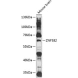Western Blot - Anti-ZNF582 Antibody (A90706) - Antibodies.com