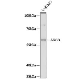Western Blot - Anti-ARSB Antibody (A90707) - Antibodies.com