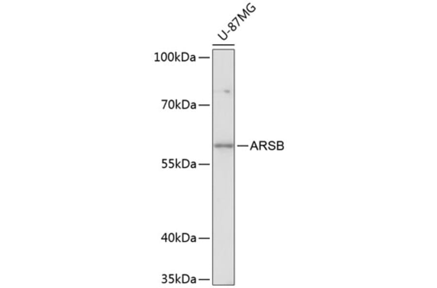 Western Blot - Anti-ARSB Antibody (A90707) - Antibodies.com