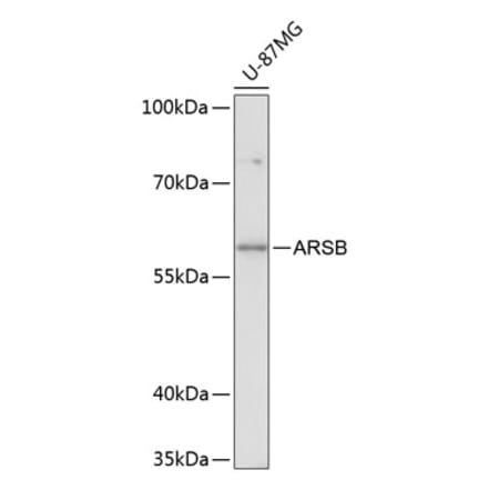 Western Blot - Anti-ARSB Antibody (A90707) - Antibodies.com