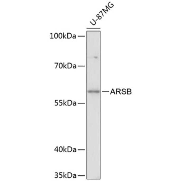 Western Blot - Anti-ARSB Antibody (A90707) - Antibodies.com