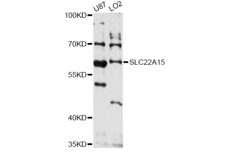 Western Blot - Anti-SLC22A15 Antibody (A14408) - Antibodies.com