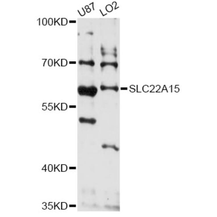 Western Blot - Anti-SLC22A15 Antibody (A14408) - Antibodies.com