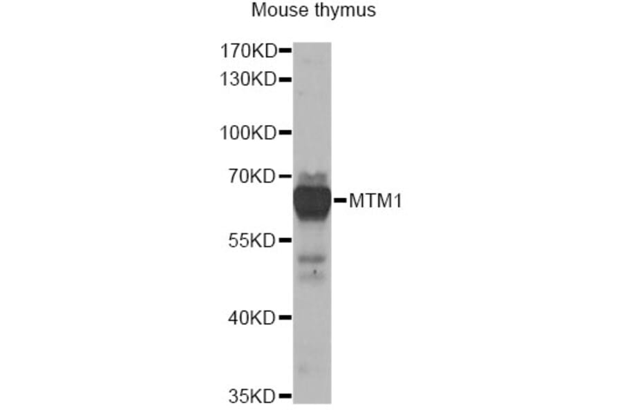 Western Blot - Anti-MTM1 Antibody (A13517) - Antibodies.com