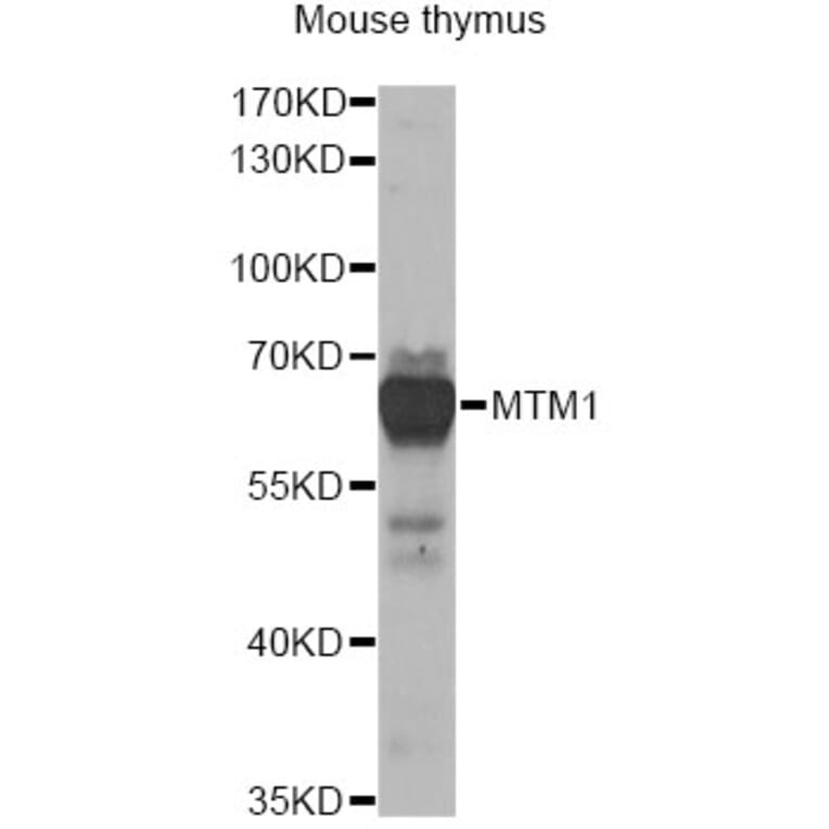 Western Blot - Anti-MTM1 Antibody (A13517) - Antibodies.com