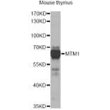 Western Blot - Anti-MTM1 Antibody (A13517) - Antibodies.com