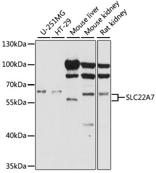 Western blot analysis of extracts of various cell lines, using Anti-SLC22A7 Antibody (A15137) at 1:1,000 dilution.
Secondary antibody: Goat Anti-Rabbit IgG (H+L) (HRP) (AS014) at 1:10,000 dilution.
Lysates / proteins: 25µg per lane.
Blocking buffer: 3% non-fat dry milk in TBST.
Detection: ECL Basic Kit (RM00020).
Exposure time: 60s.