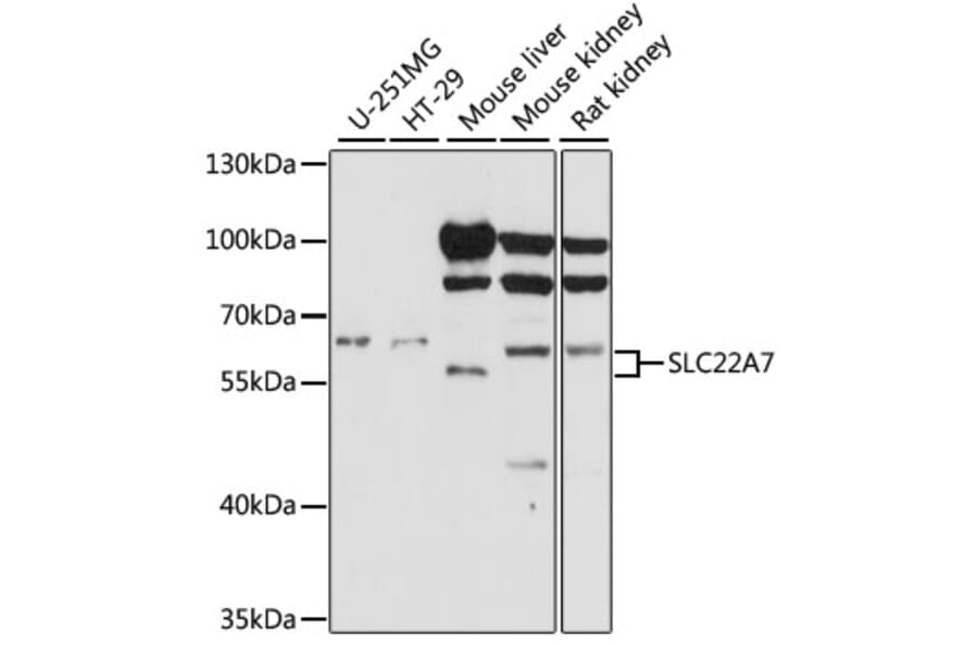 Western Blot - Anti-SLC22A7/OAT2 Antibody (A90710) - Antibodies.com