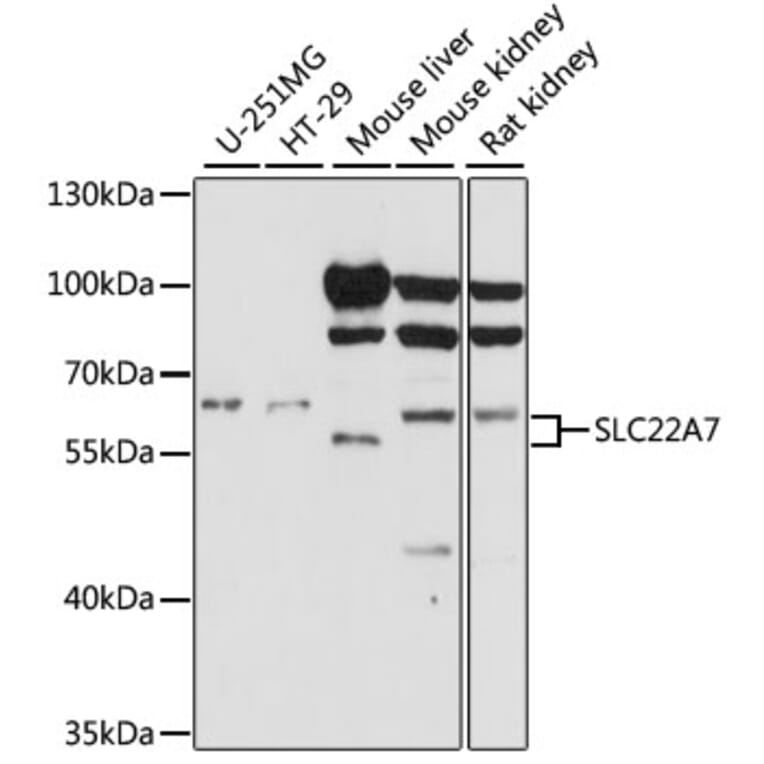 Western Blot - Anti-SLC22A7/OAT2 Antibody (A90710) - Antibodies.com