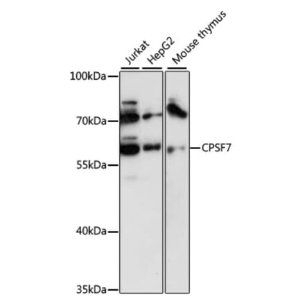 Western Blot - Anti-CPSF7 Antibody (A90711) - Antibodies.com