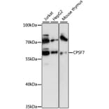 Western Blot - Anti-CPSF7 Antibody (A90711) - Antibodies.com