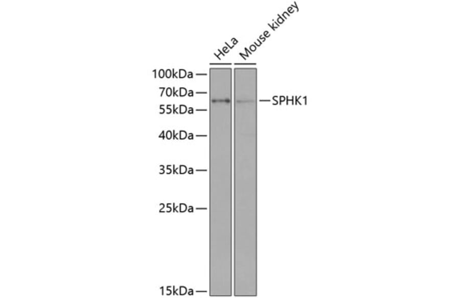 Western Blot - Anti-SPHK1 Antibody (A90712) - Antibodies.com
