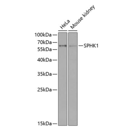 Western Blot - Anti-SPHK1 Antibody (A90712) - Antibodies.com