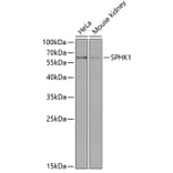 Western Blot - Anti-SPHK1 Antibody (A90712) - Antibodies.com