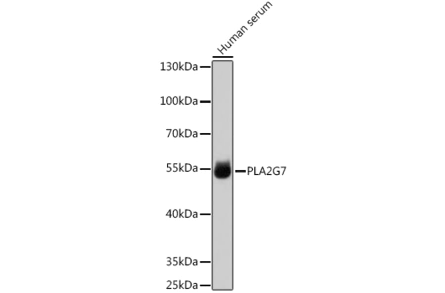 Western Blot - Anti-PLA2G7 Antibody (A90713) - Antibodies.com