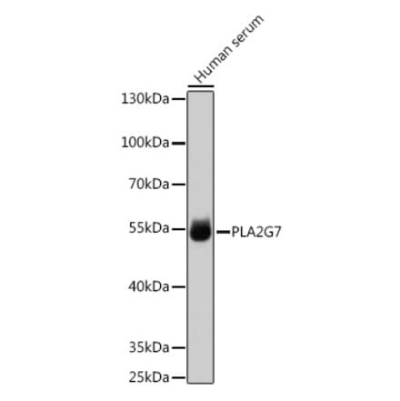 Western Blot - Anti-PLA2G7 Antibody (A90713) - Antibodies.com