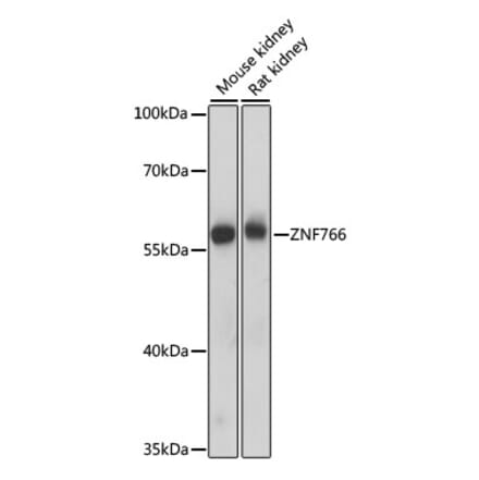 Western Blot - Anti-ZNF766 Antibody (A90714) - Antibodies.com