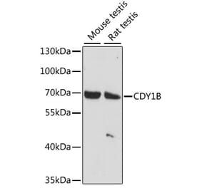 Western Blot - Anti-CDY1 Antibody (A90715) - Antibodies.com