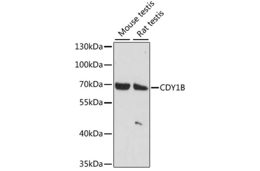 Western Blot - Anti-CDY1 Antibody (A90715) - Antibodies.com