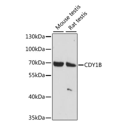Western Blot - Anti-CDY1 Antibody (A90715) - Antibodies.com