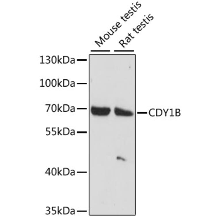 Western Blot - Anti-CDY1 Antibody (A90715) - Antibodies.com