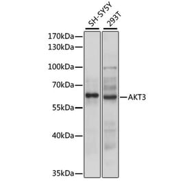 Western Blot - Anti-AKT3 Antibody (A90716) - Antibodies.com