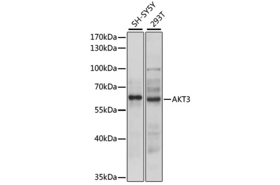 Western Blot - Anti-AKT3 Antibody (A90716) - Antibodies.com