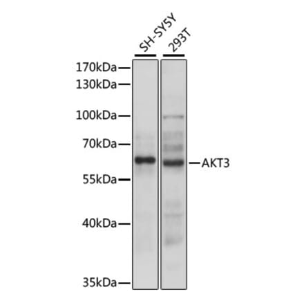 Western Blot - Anti-AKT3 Antibody (A90716) - Antibodies.com
